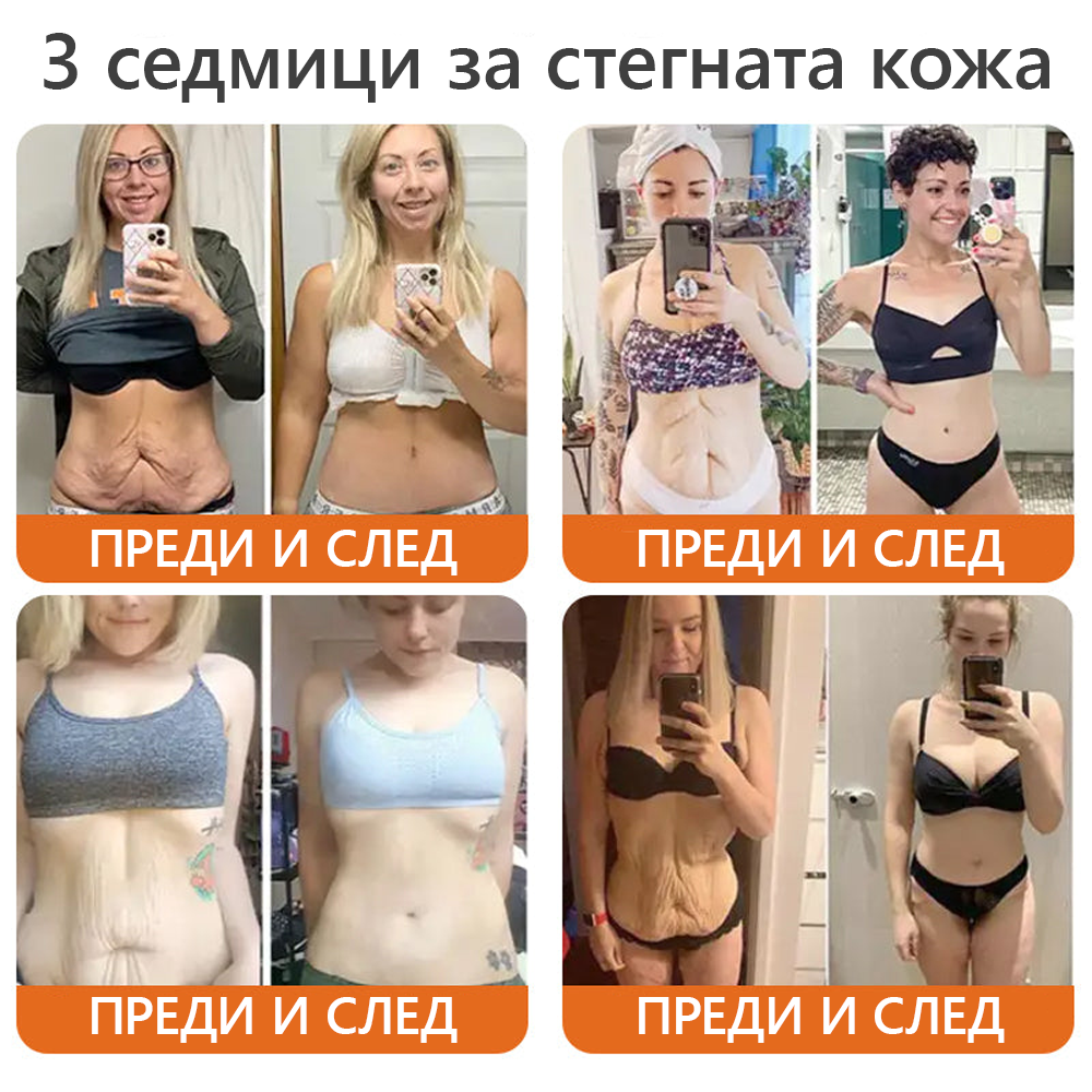 Произведено и доставено от България 👑𝐃𝐨𝐫𝐦𝐨𝗿𝗻𝗮® пчелна отрова комплексен крем🌟ПОСЛЕДЕН ДЕН 80% ОТСТЪПКА 🔥🔥