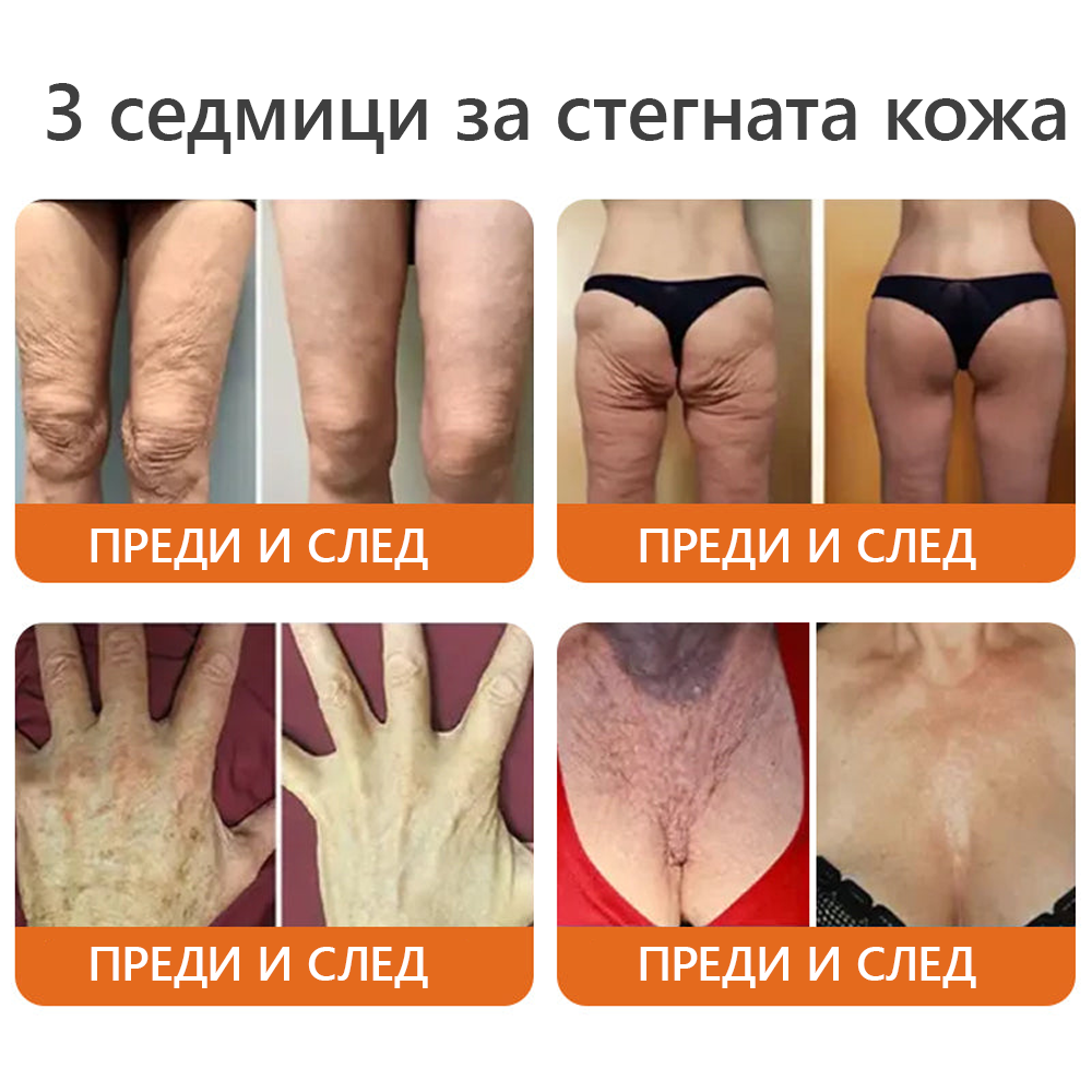 Произведено и доставено от България 👑𝐃𝐨𝐫𝐦𝐨𝗿𝗻𝗮® пчелна отрова комплексен крем🌟ПОСЛЕДЕН ДЕН 80% ОТСТЪПКА 🔥🔥