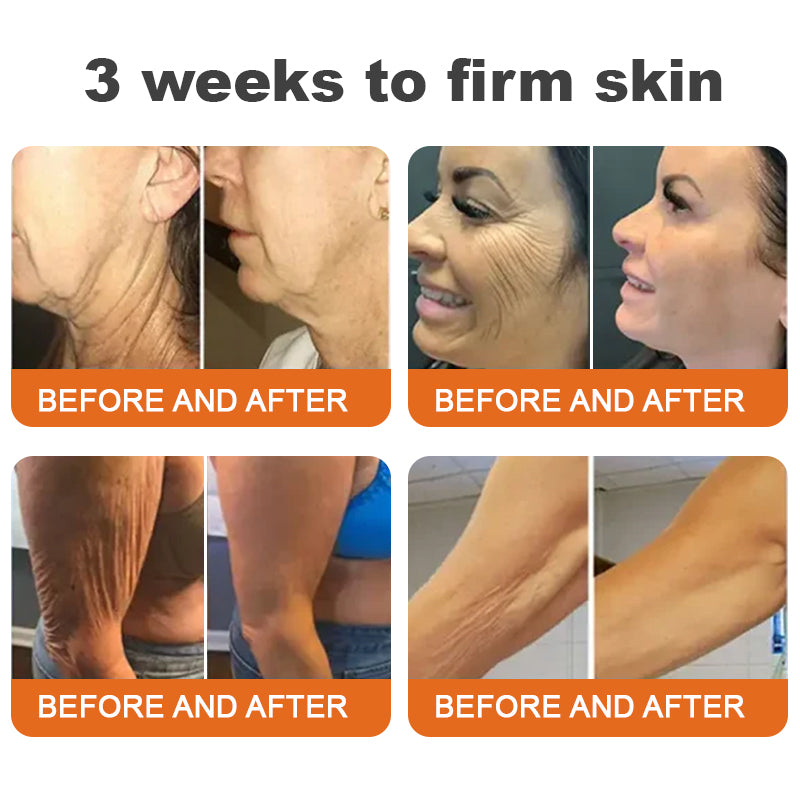 🐝Произведено и изпратено от САЩ✨Flysmus™ Botox Bee Venom Firming Serum Stick🔥ПОСЛЕДЕН ДЕН 70% ОТСТЪПКА