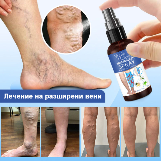 Veinhealing™ ✨Спрей за лечение на разширени вени✅ Клинично доказано, че елиминира разширените вени само за 7 дни!