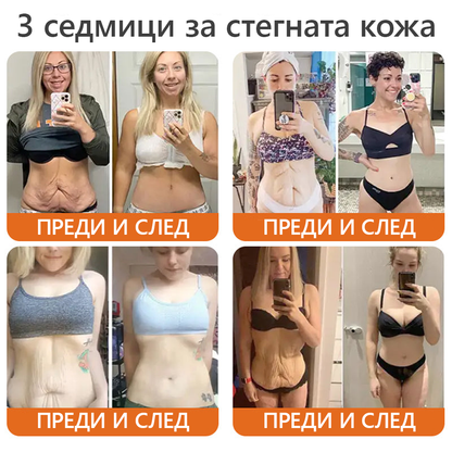Произведено и доставено от България 👑𝐃𝐨𝐫𝐦𝐨𝗿𝗻𝗮® пчелна отрова комплексен крем🌟ПОСЛЕДЕН ДЕН 80% ОТСТЪПКА 🔥🔥