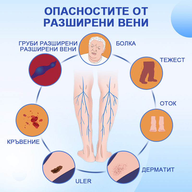 Veinhealing™ ✨Спрей за лечение на разширени вени✅ Клинично доказано, че елиминира разширените вени само за 7 дни!