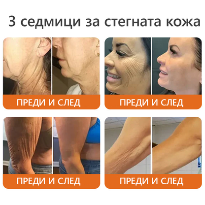 Произведено и доставено от България 👑𝐃𝐨𝐫𝐦𝐨𝗿𝗻𝗮® пчелна отрова комплексен крем🌟ПОСЛЕДЕН ДЕН 80% ОТСТЪПКА 🔥🔥