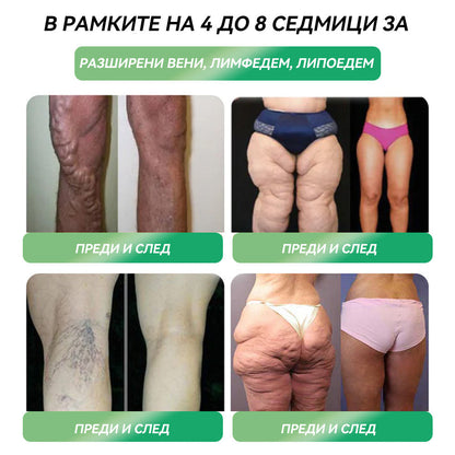 🏥Препоръки на Медицинската университетска болница в София| официален магазин | 🍀𝑆𝑇𝐷𝘌𝘐® 𝐺𝐿𝑃-1 Отслабване Орален разтвор -👨‍⚕️Затлъстяване, сърдечно-съдови заболявания, диабет, сънна апнея, проблеми със ставите и други
